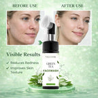 GreenVibe Green Tea Face Wash – Oil Control, Pore Cleansing & Balanced Skin | With Green Tea + Niacinamide + Glycolic Acid | 150ml