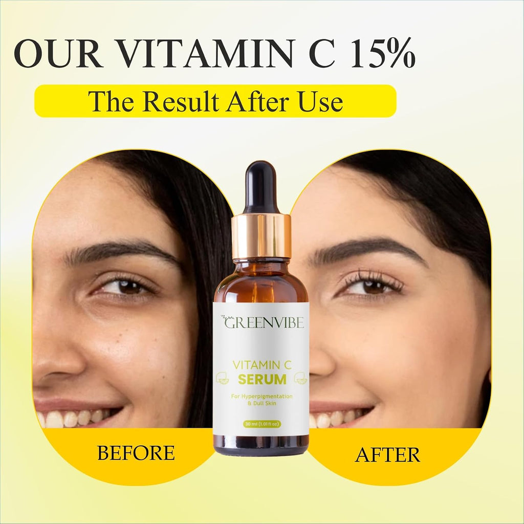 Greenvibe Vitamin C Face Serum 30ml | Brightening & Hydrating Serum for Glowing Skin | Lightweight & Fast Absorbing Formula