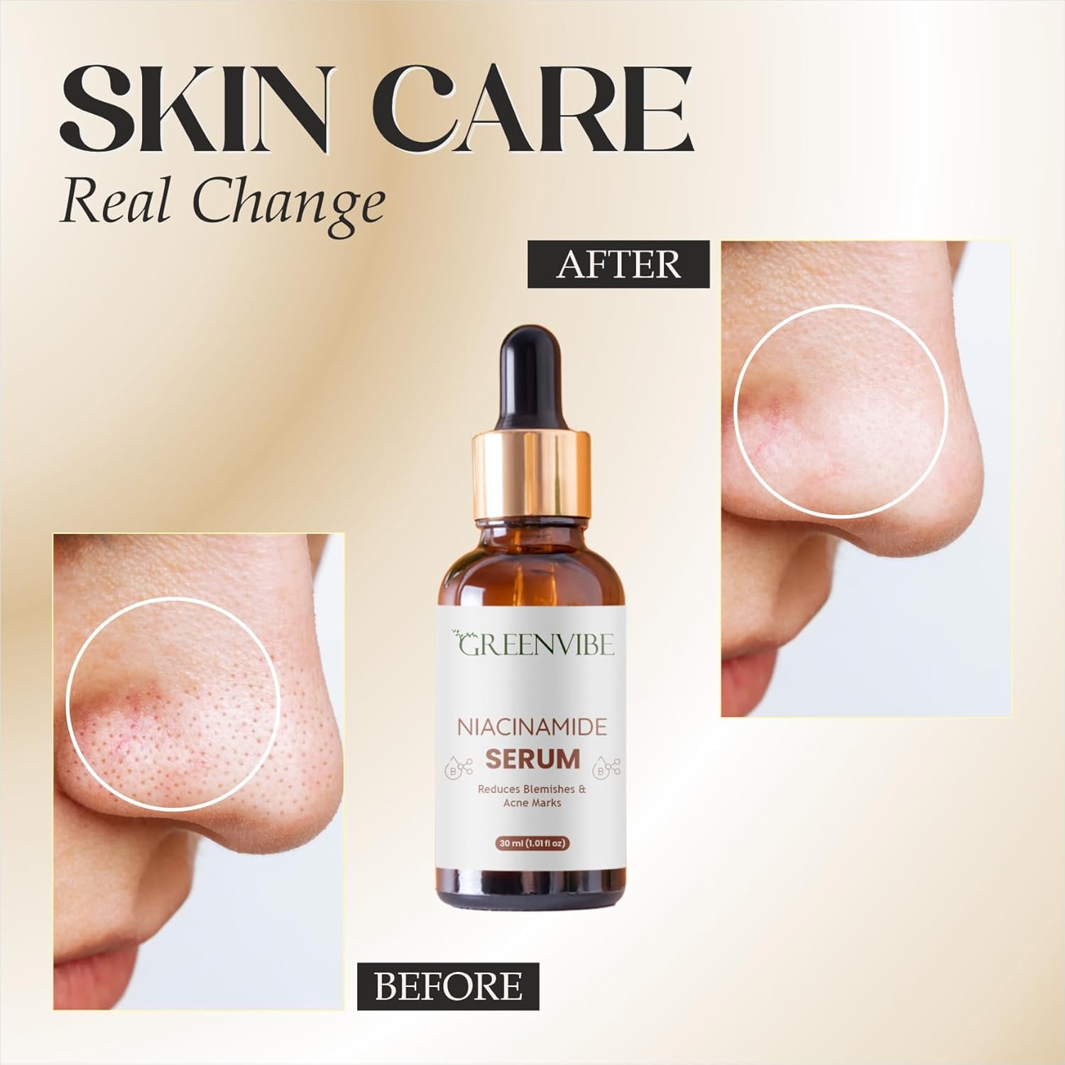 Niacinamide Face Serum 30ml | 10% Niacinamide + Zinc PCA + Hyaluronic Acid | Minimizes Pores | Controls Oil | Brightens Skin | For Oily, Combination & Blemish-Prone Skin | All Skin Types